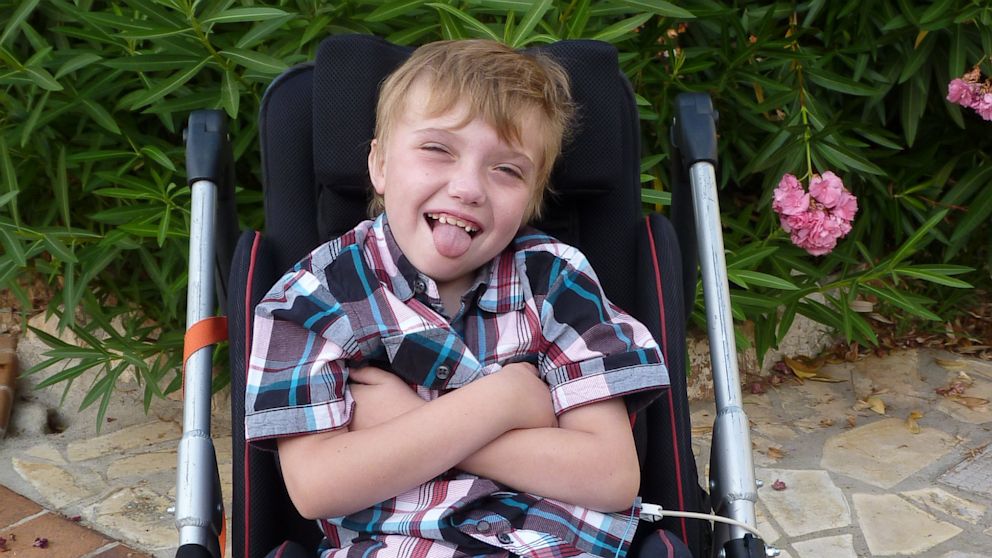 Louis Mushrow cries when he hears music due to Smith-Magenis syndrome. 