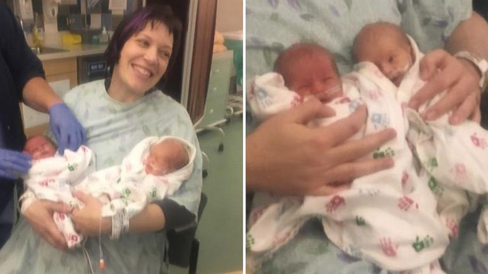 PHOTO: Jon and Amy Bertoletti welcomed twins Molly (left) and Estelle (right) into their family on April 5, 2016. They were one of 17 sets of twins that were delivered in Advocate Children's Hospital in Oak Lawn in the first week of April.