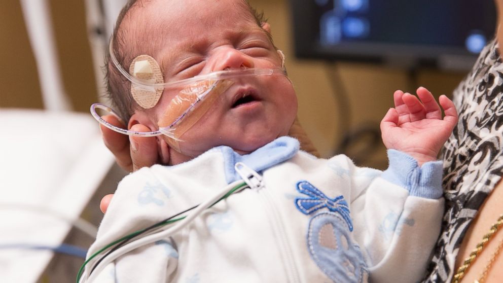 Baby Delivered by Brain-Dead Mother on Life Support for 54 Days
