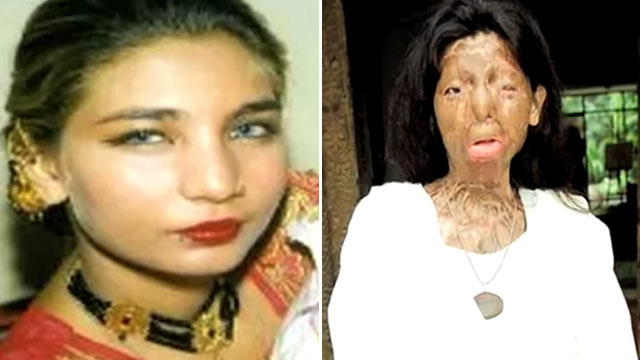 Image result for ACID ATTACK IMAGES