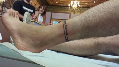 Man Documents Final Adventures with Leg Before Amputation - ABC News