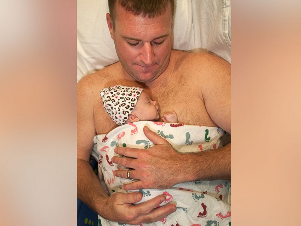 PHOTO: Dads and other relatives can have kangaroo care time, too.