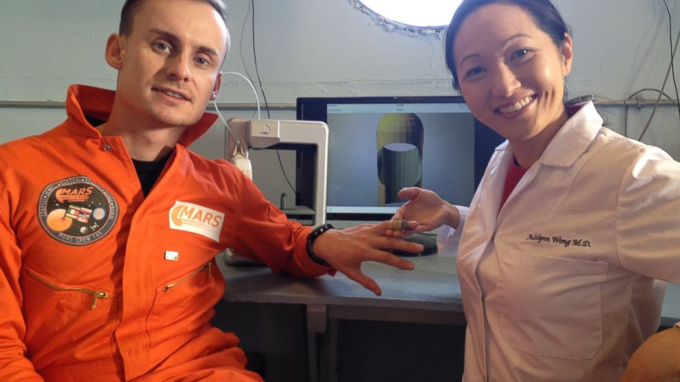 PHOTO: Dr. Julielynn Wong 3D printed a customized finger splint with "Star Trek Replicator."