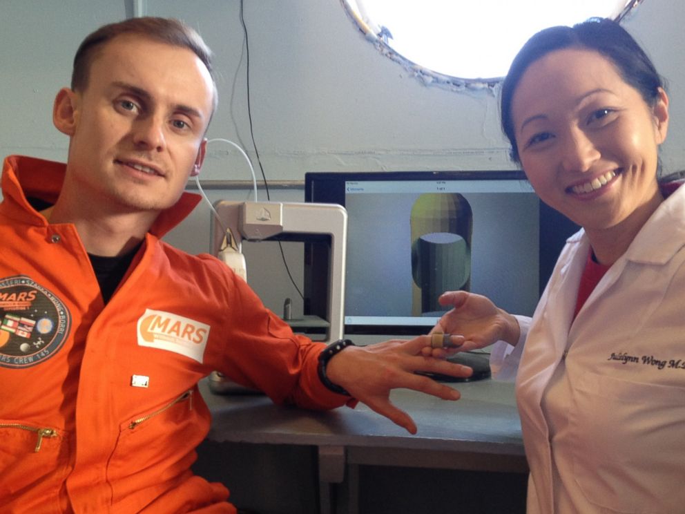 PHOTO: Dr. Julielynn Wong 3D printed a customized finger splint with "Star Trek Replicator."