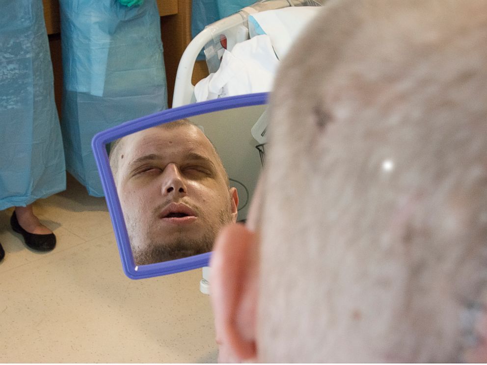 Pat Hardison sees himself for the first time on Aug. 24, 2015, after his face transplant surgery at NYU Langone Medical Center. 