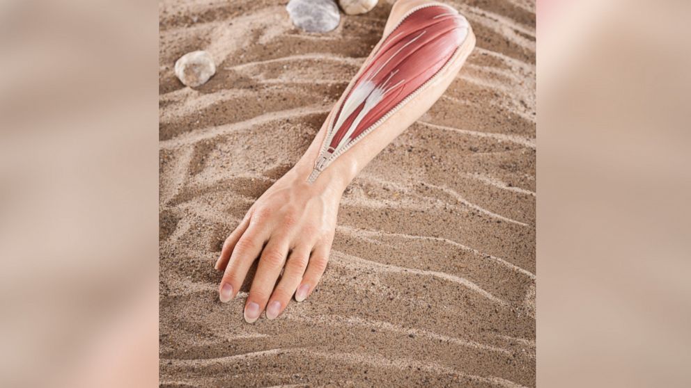 PHOTO: A lifelike arm prosthetic designed by stamos + braun prothesenwerk gmbh.