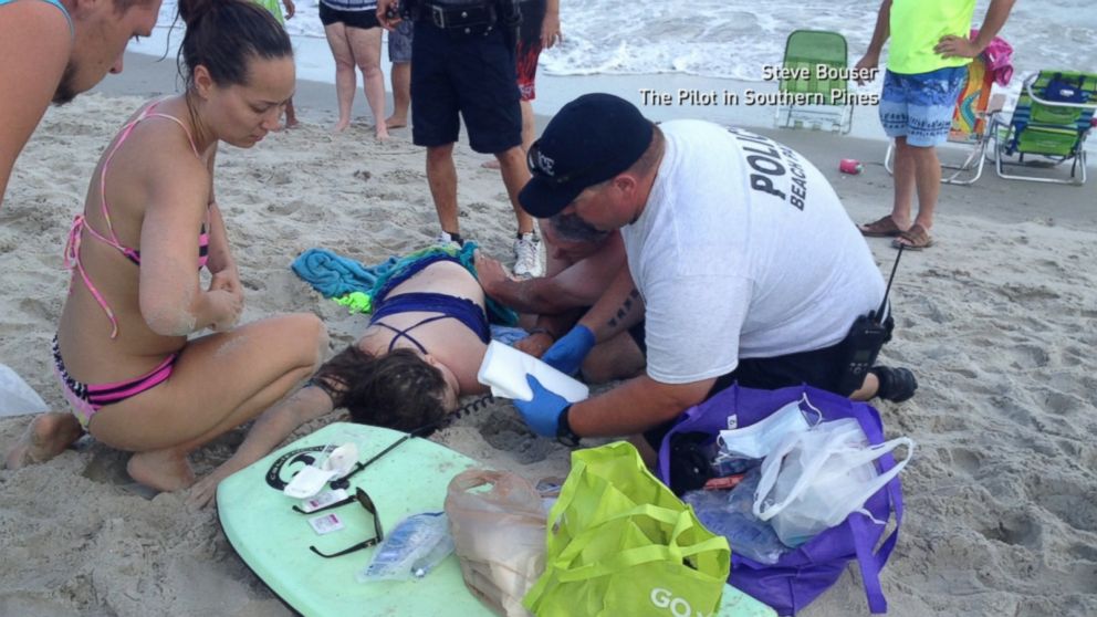 Kiersten Yow is pictured after a shark attacked her.