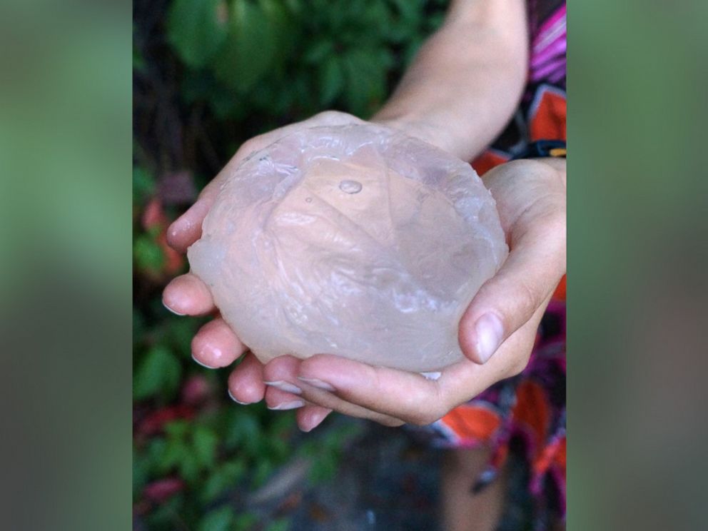 PHOTO: This Ooho edible bottle could potentially replace environmentally unfriendly plastic bottles.