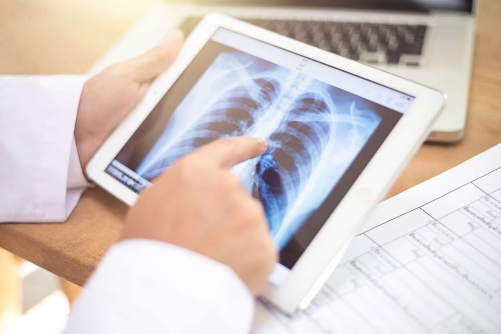 PHOTO: A doctor using a tablet to look at a chest x-ray. 