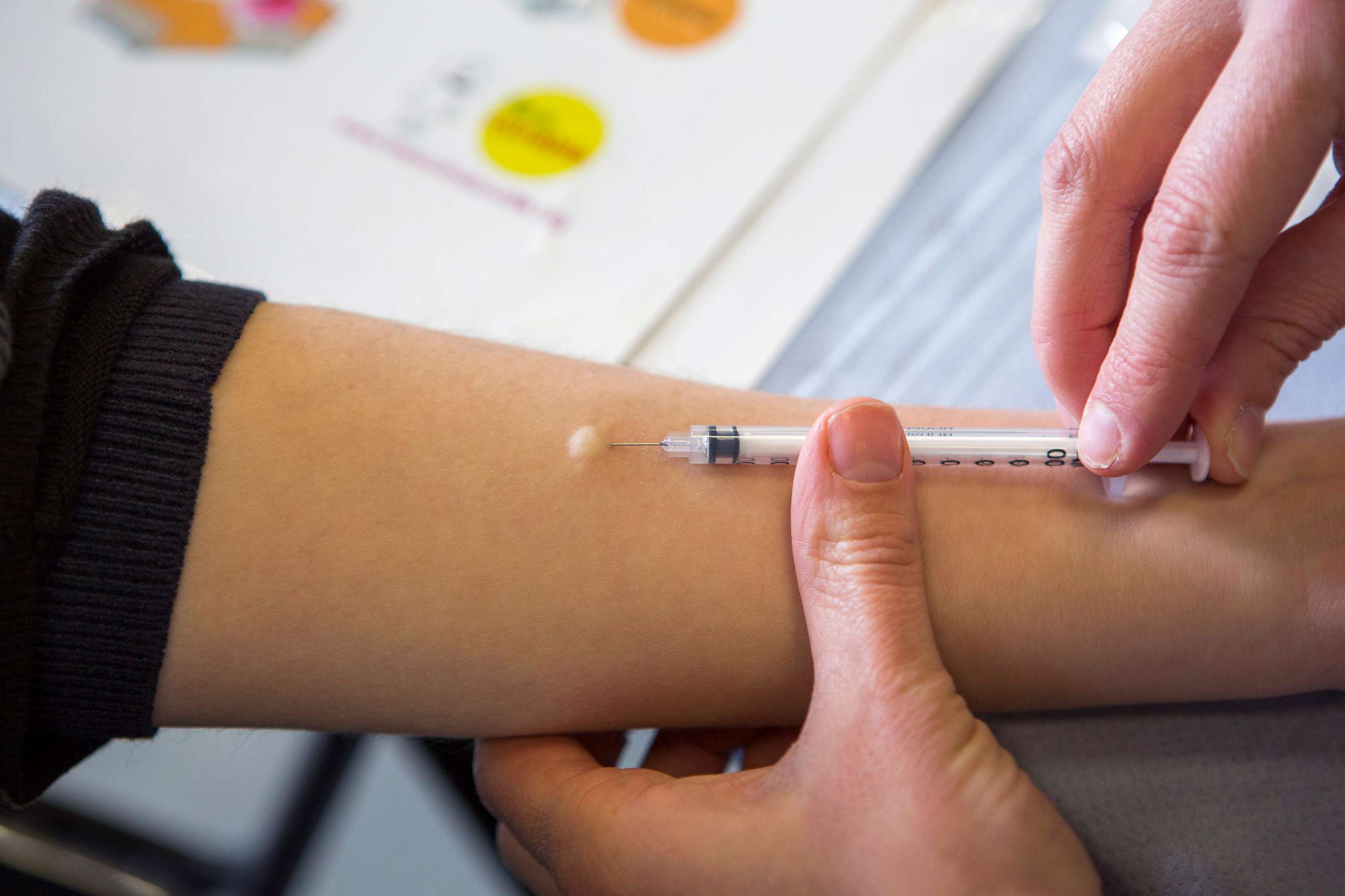 PHOTO: A nurse performs an intradermal injection of the Mantoux PPD skin test on a person's forearm, March 31, 2015, in London