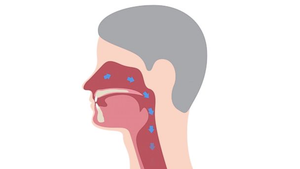 Tiny device could help people who suffer from chronic breathing ...