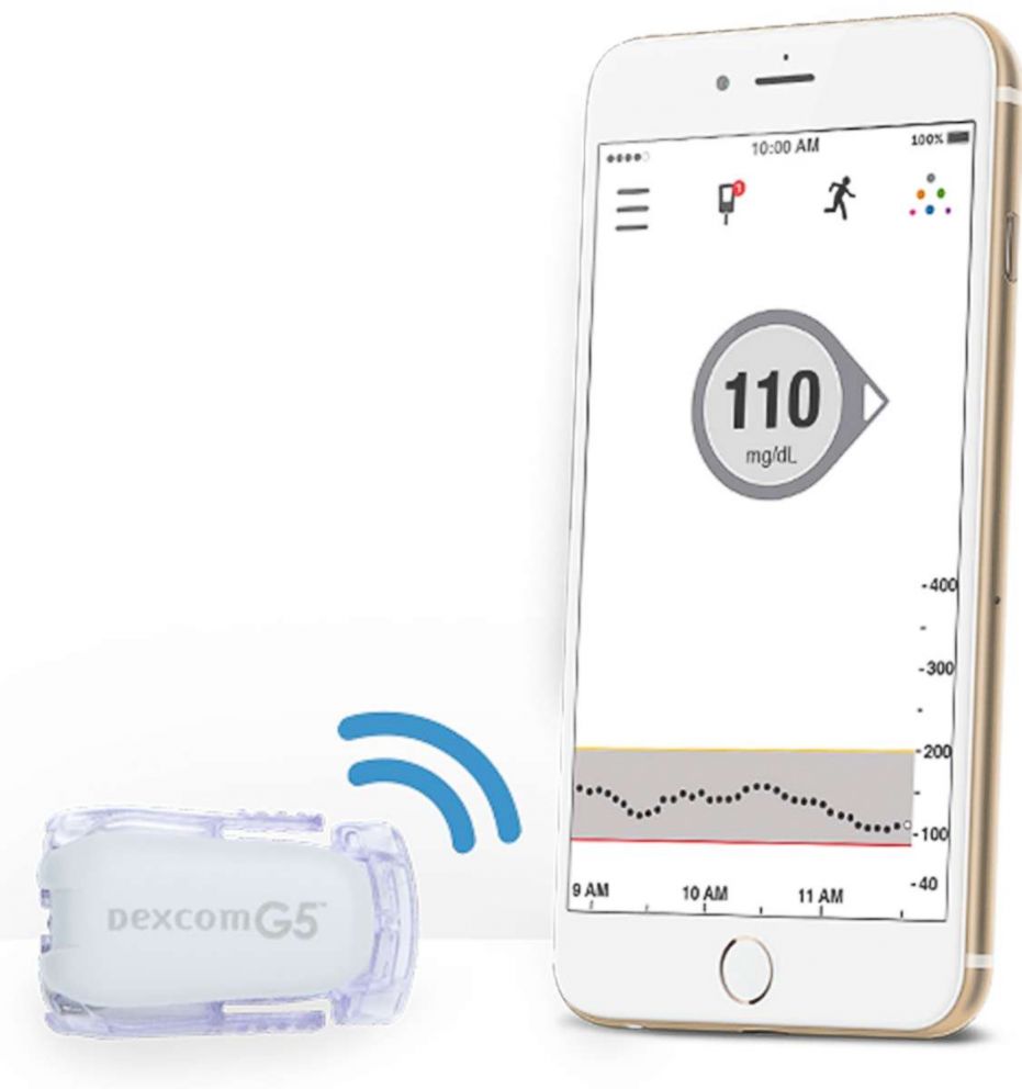 PHOTO: Dexcom's G5 CGM can be monitoring using an iPhone application.