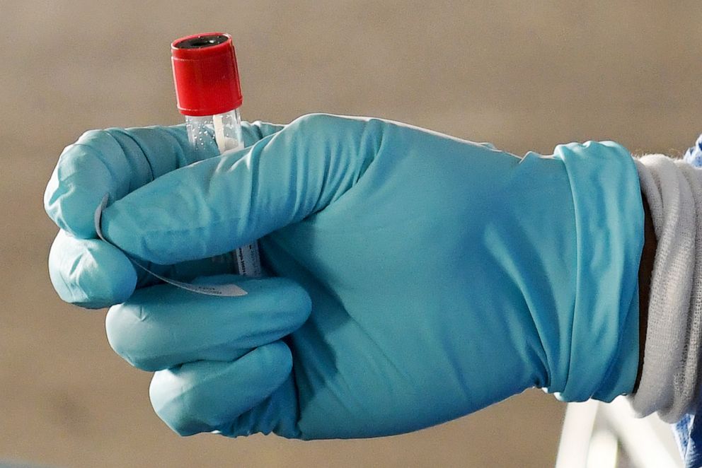 PHOTO: A coronavirus specimen sampling tube is prepared for testing during a preview of a free drive-thru COVID-19 testing site in Las Vegas, Nov. 12, 2020.