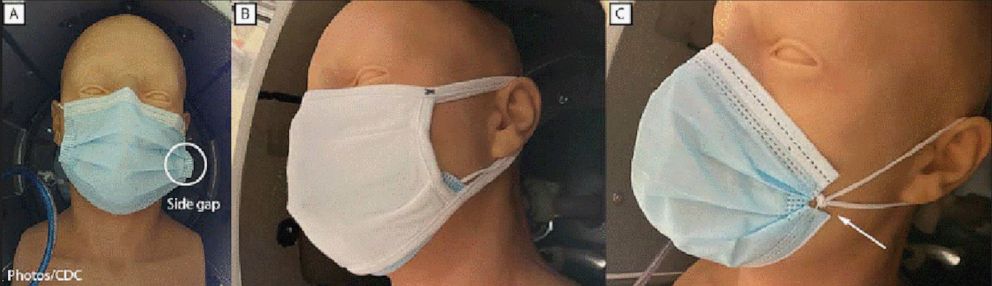 PHOTO: Masks tested, from left, A, unknotted medical procedure mask; B, double mask (cloth mask covering medical procedure mask); and C, knotted/tucked medical procedure mask.