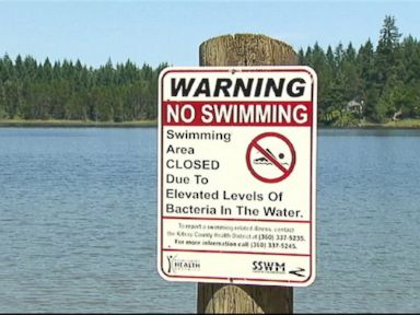 VIDEO: A norovirus is suspected of sickening people who swam in Horseshoe Lake over the weekend.