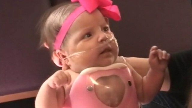 Baby Born With Heart Outside Body Leaves Hospital Video ...