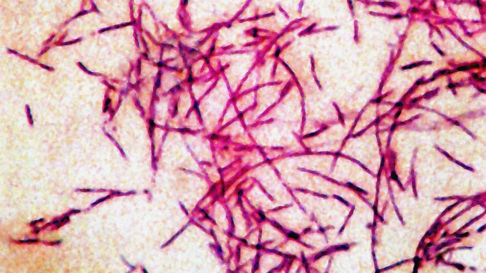 This city is experiencing a cluster of Legionnaires' with at least 18 cases
