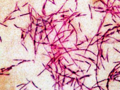 Second person dies in legionnaires’ disease outbreak in New York City - image 4