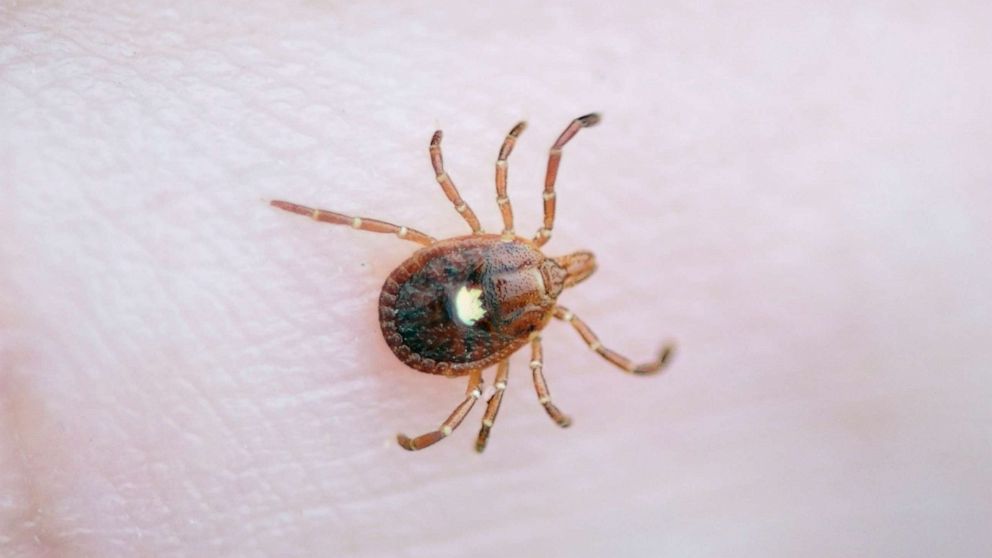 PHOTO: The Lone Star Tick, Amblyomma Americanum, is pictured crawling on a finger.