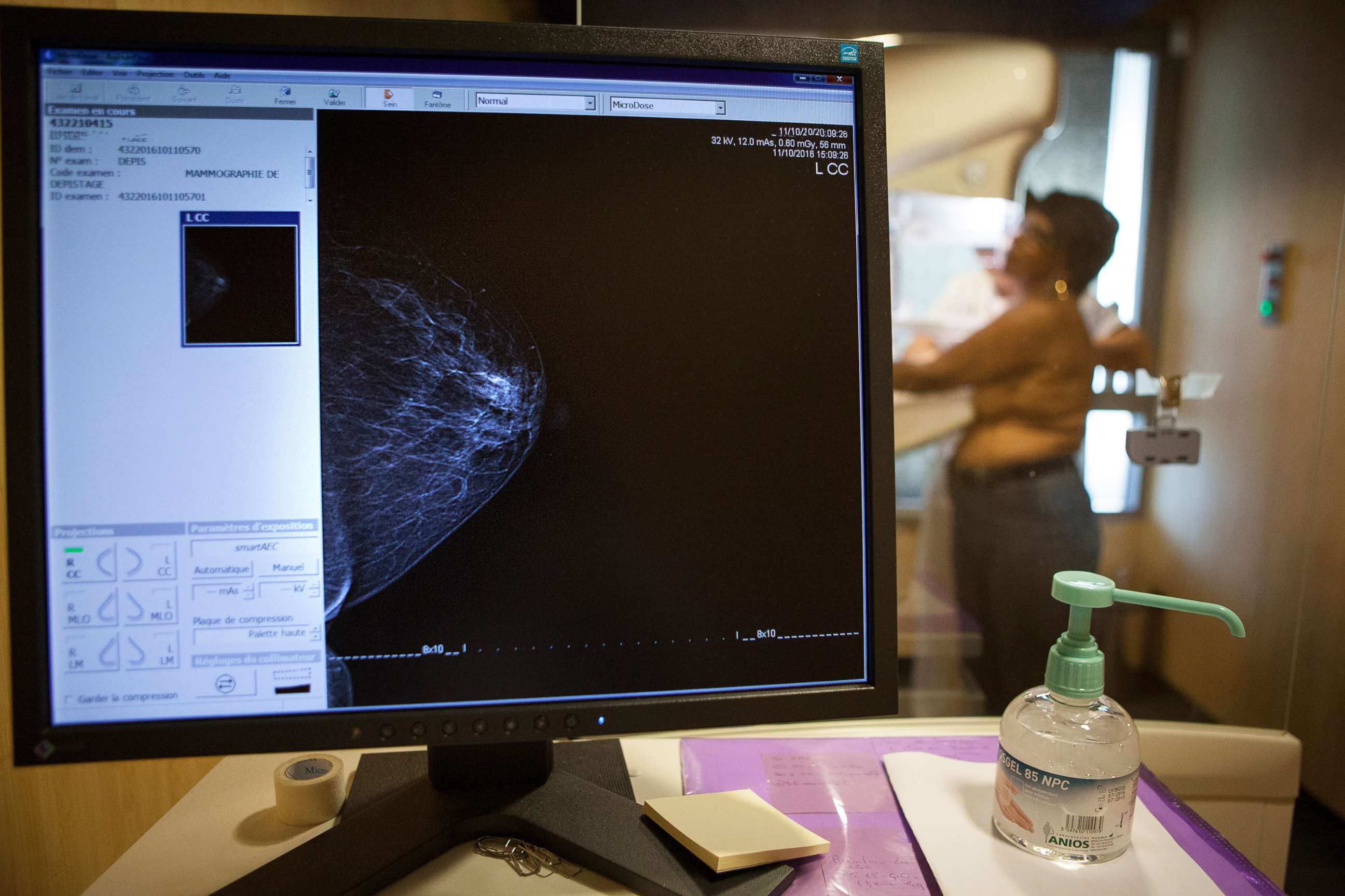 PHOTO: PHOTO: A technician carries out a routine mammogram in France, Nov. 29, 2016.