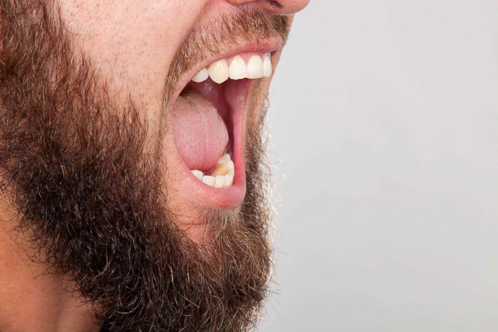 PHOTO: A man screams in this undated stock photo.