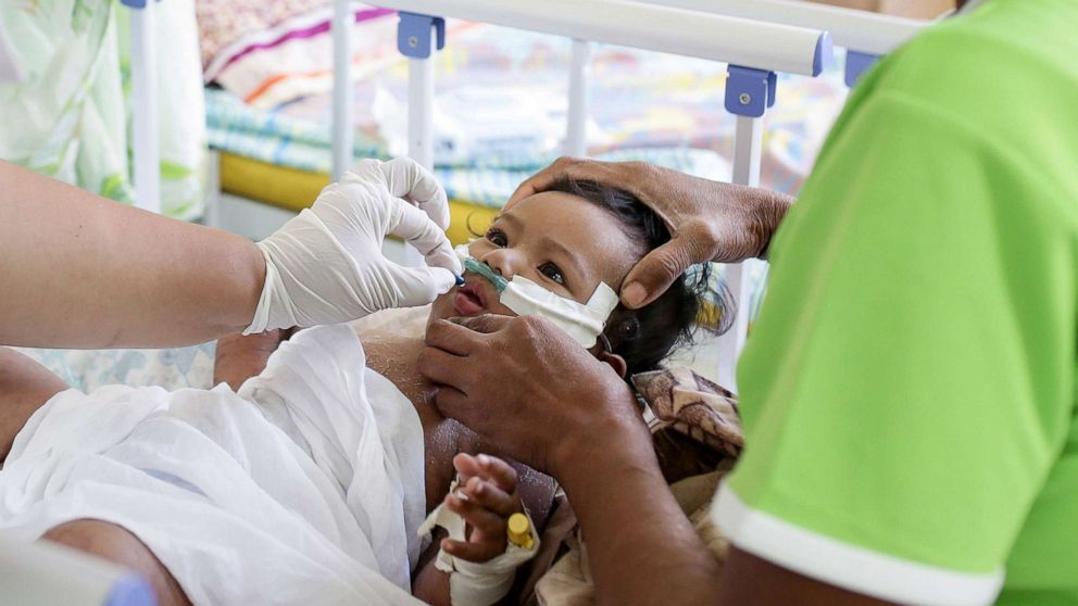 Worldwide measles deaths surge, reversing years of progress - ABC News