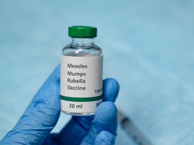 7th measles case confirmed in outbreak linked to elementary school in this state