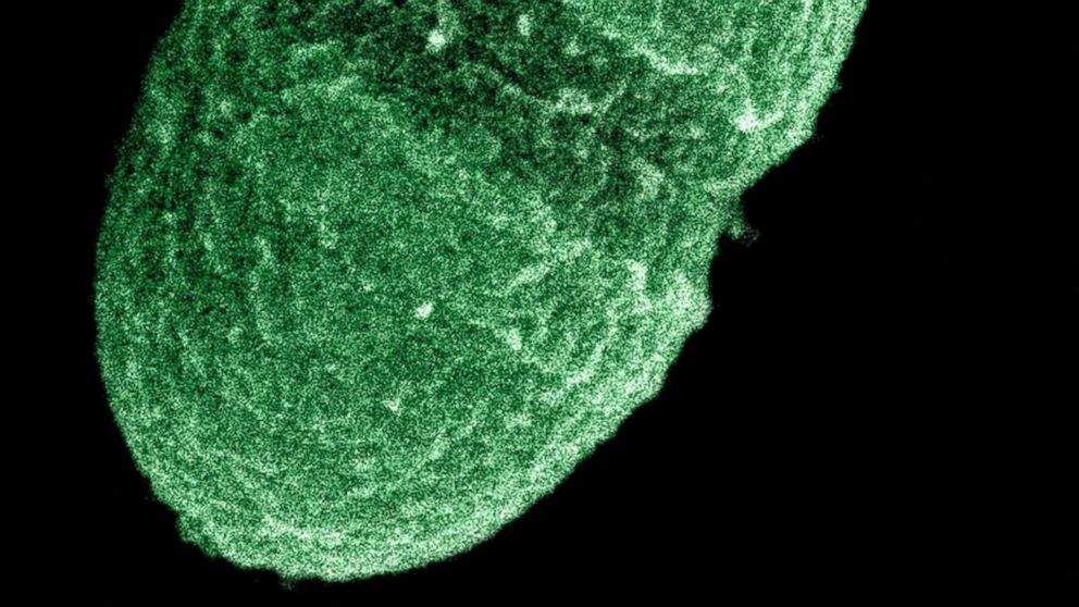 The bacterium, Enterococcus faecalis, which lives in the human gut, is just one type of microbe that will be studied as part of NIH's Human Microbiome Project.