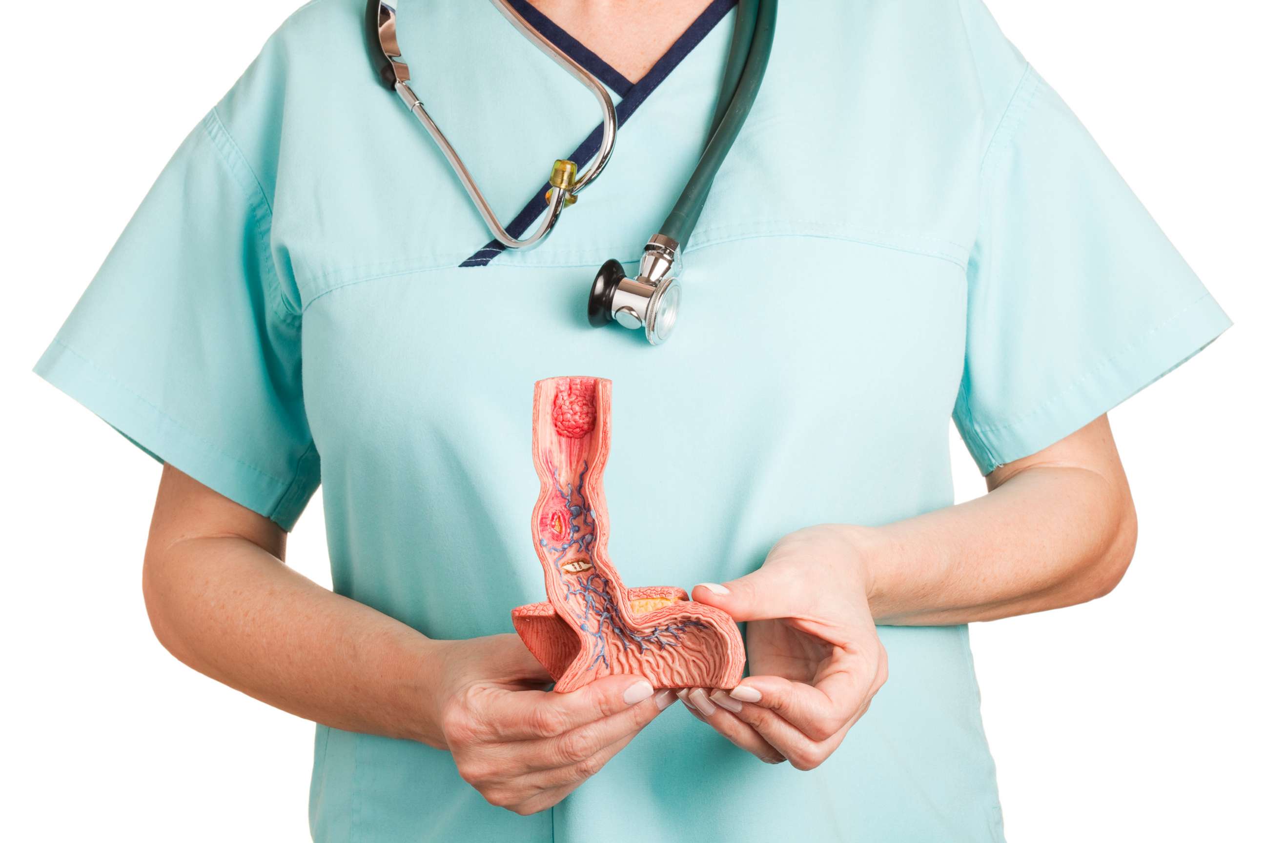 PHOTO: A person holds an anatomical model of a diseased human esophagus.