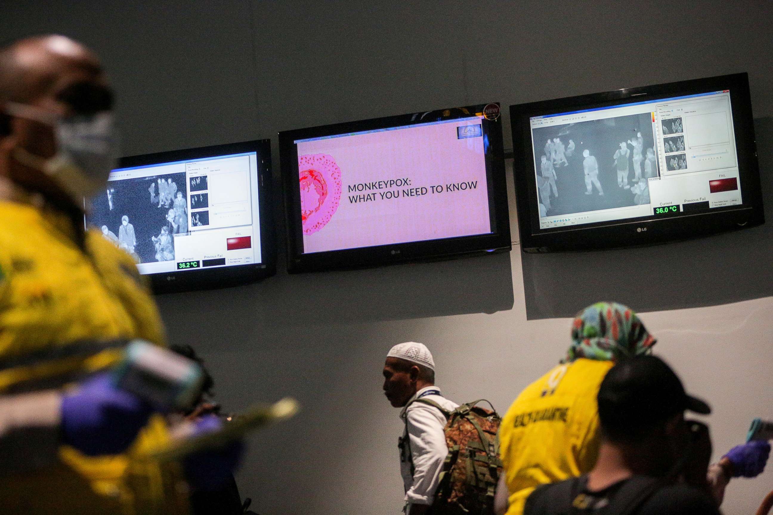 PHOTO: A health officer stands in front of a monkeypox virus information sign, May 15, 2019, at the airport in Tangerang near Jakarta, Indonesia. 