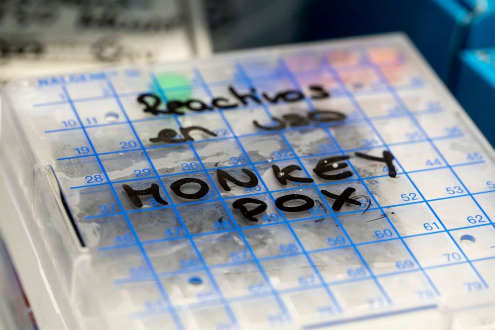 PHOTO: A reactive to test suspected monkeypox samples is seen inside a fridge at the microbiology laboratory of La Paz Hospital on June 6, 2022 in Madrid.