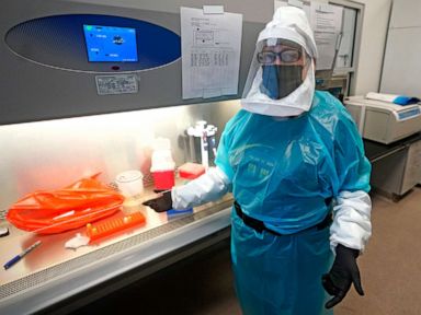 2 more children in US test positive for monkeypox