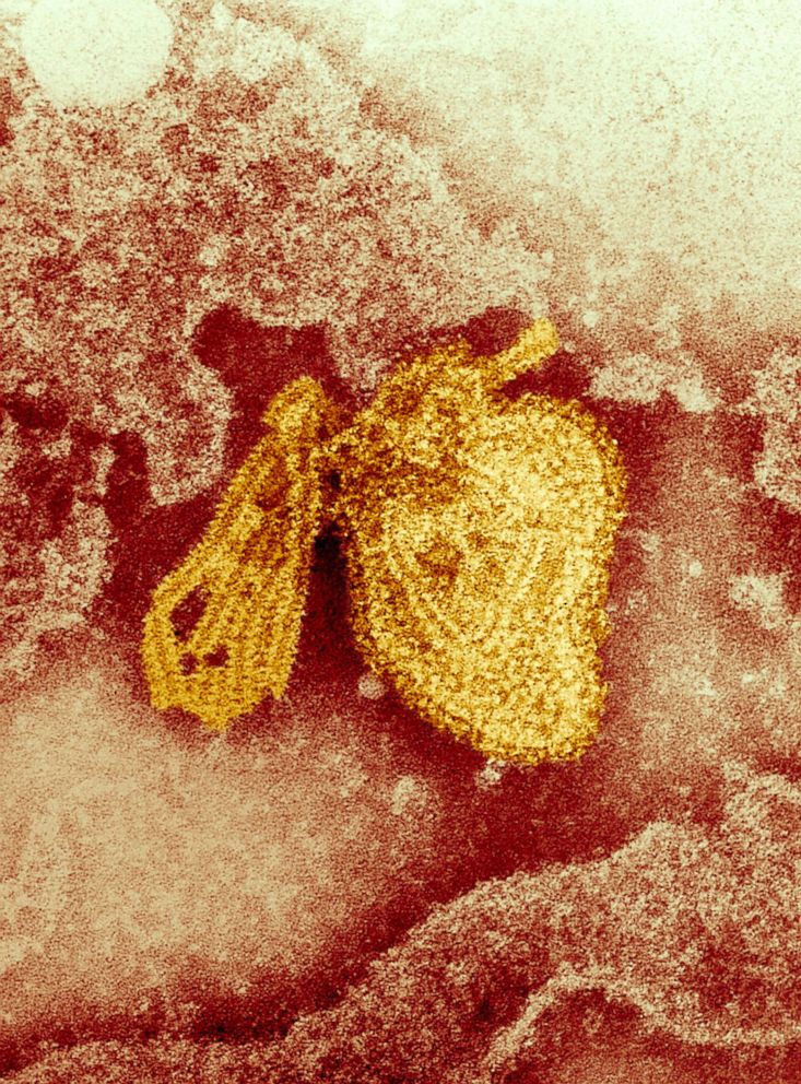 PHOTO: Electron micrograph of the mumps virus. 