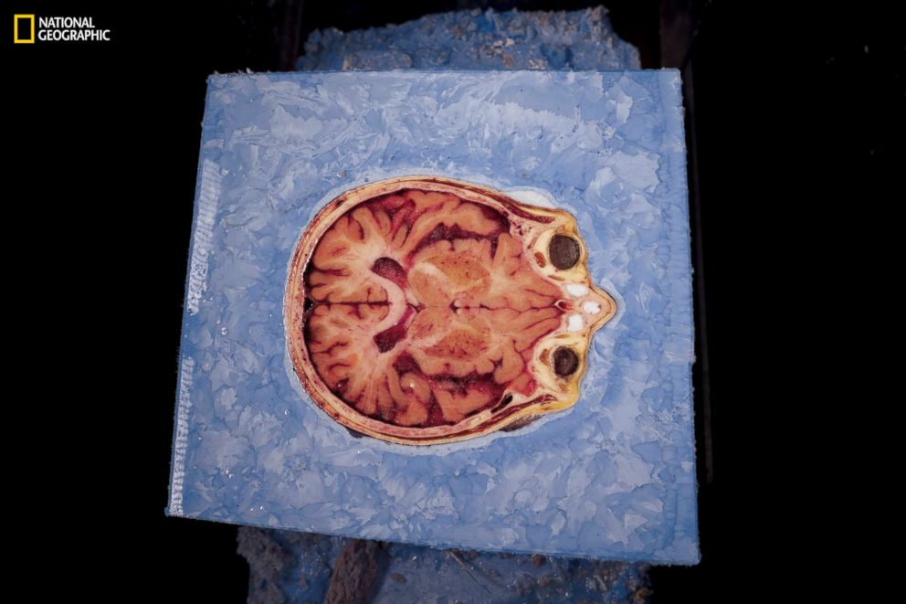 PHOTO: This cross section is of Potter’s head, encased in polyvinyl alcohol for stability. It shows her brain, eyes, and nose as the skull is sliced, from the top down, in the cryomacrotome, as Spitzer calls the milling machine.