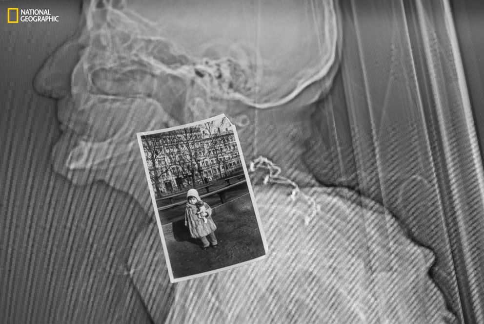 PHOTO: Born in Leipzig, Germany, Potter was three in this photograph taken in her native country. The ghostly CT scan in the background was done upon her death at age 87.