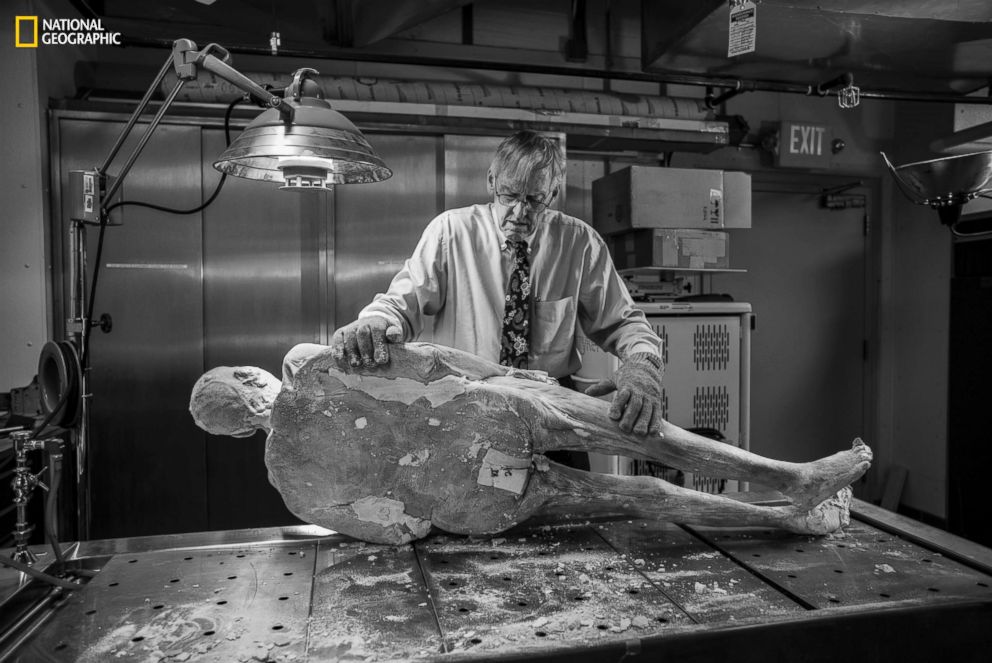 PHOTO: Vic Spitzer, director of the Center for Human Simulation, prepares to pry out a titanium rod from Potter's hip replacement. Left in place, it might have destroyed the cutting blade.