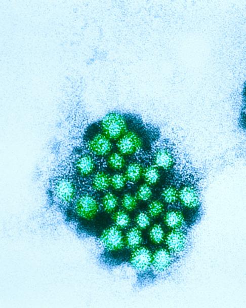 norovirus glp 1 GLP-1 and Anesthesia: Considerations and Cautions for CRNAs norovirus glp 1 Potential Use