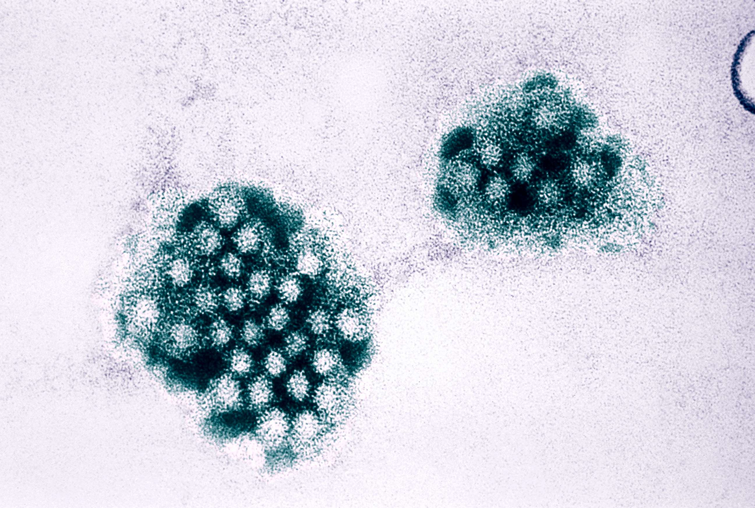 PHOTO: In this undated file photo, an electron micrograph of the norovirus is shown.