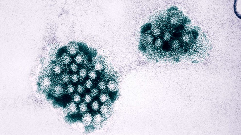 PHOTO: In this undated file photo, an electron micrograph of the norovirus is shown.