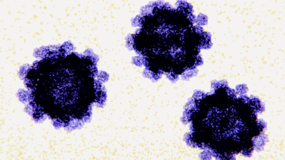 PHOTO: Norovirus virus particles, illustration