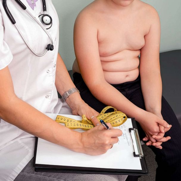 The New Childhood Obesity Guidelines Are Appalling, Experts Say