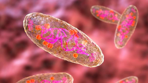 New Mexico man dies of plague in state's 1st fatality since 2020: Officials - Vimarsana News