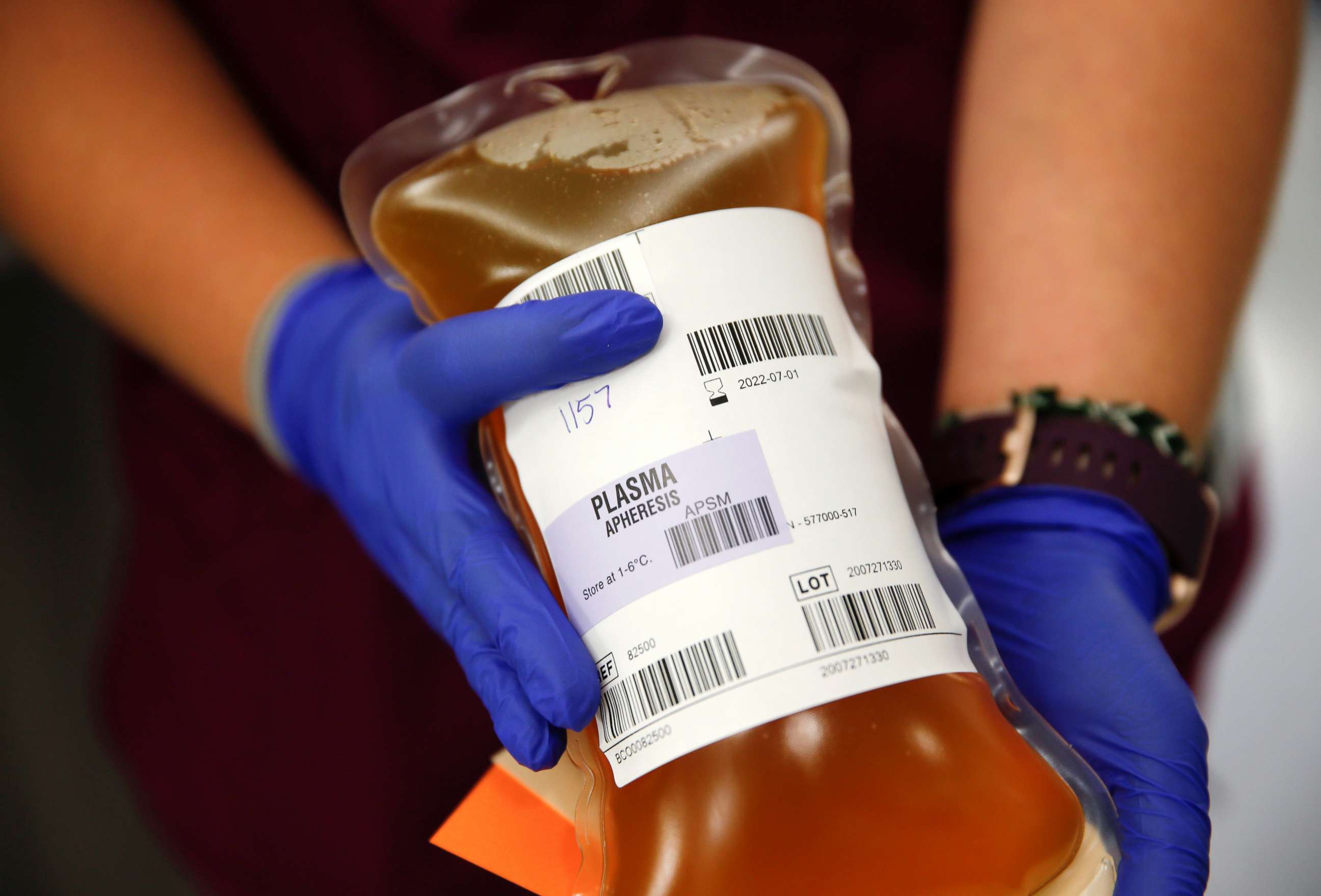 PHOTO: Blood collection specialist Kathryn Severson holds a bag of convalescent plasma from a recovered coronavirus patient at the Central Seattle Donor Center of Bloodworks Northwest during the COVID-19 outbreak, in Seattle, Sept. 2, 2020.