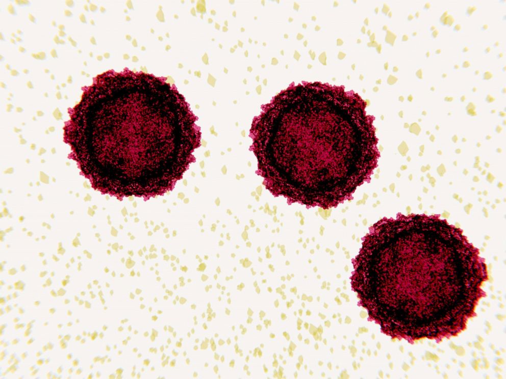 PHOTO: This illustration shows polio virus particles.