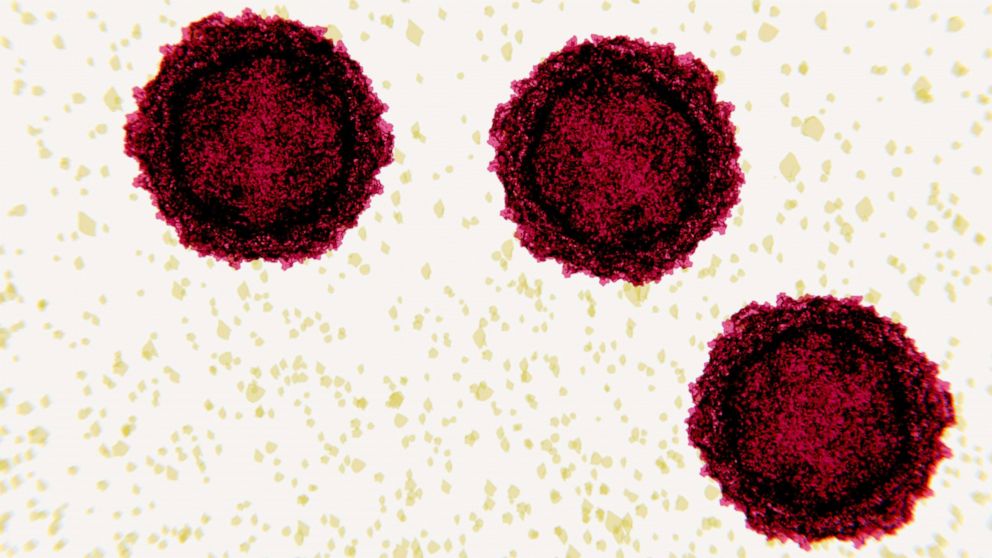 PHOTO: Polio virus particles are shown.