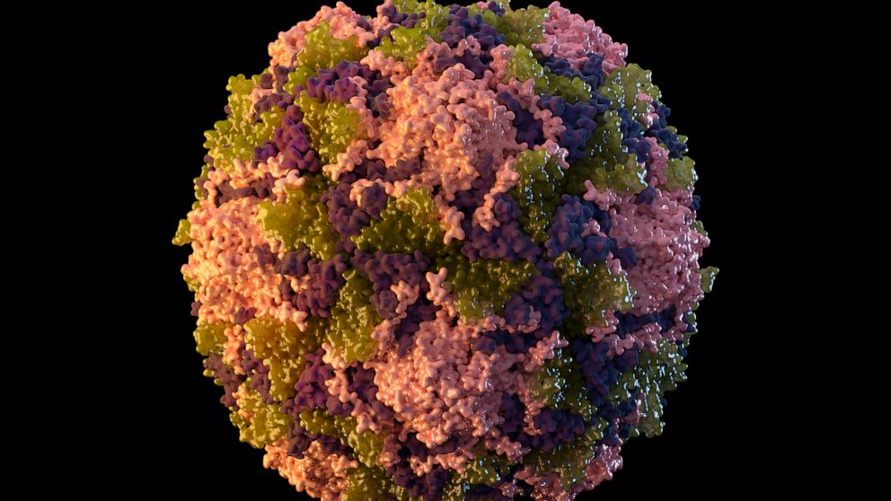 PHOTO: This 2014 illustration made available by the United States Centers for Disease Control and Prevention depicts a polio virus particle.  On Thursday, July 21, 2022, New York health officials reported a case of polio, the first in the United States in nearly a decade. 
