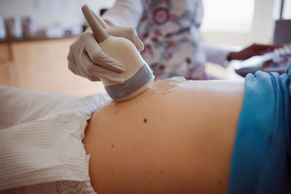 PHOTO: A pregnant woman gets an ultrasound in this undated stock photo.