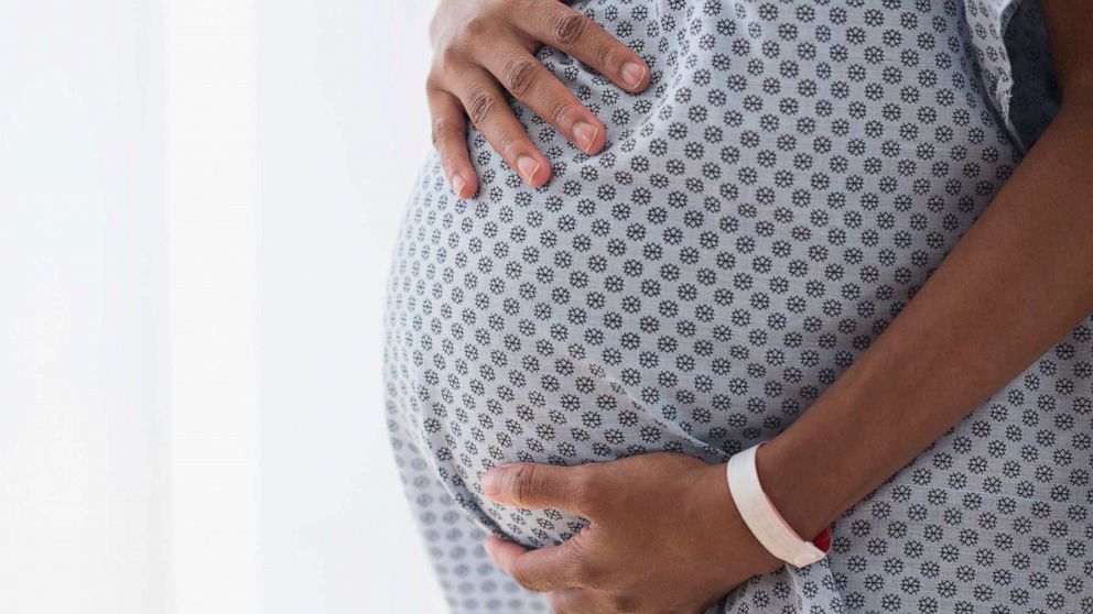 4 in 5 pregnancy-related deaths are preventable, CDC report finds