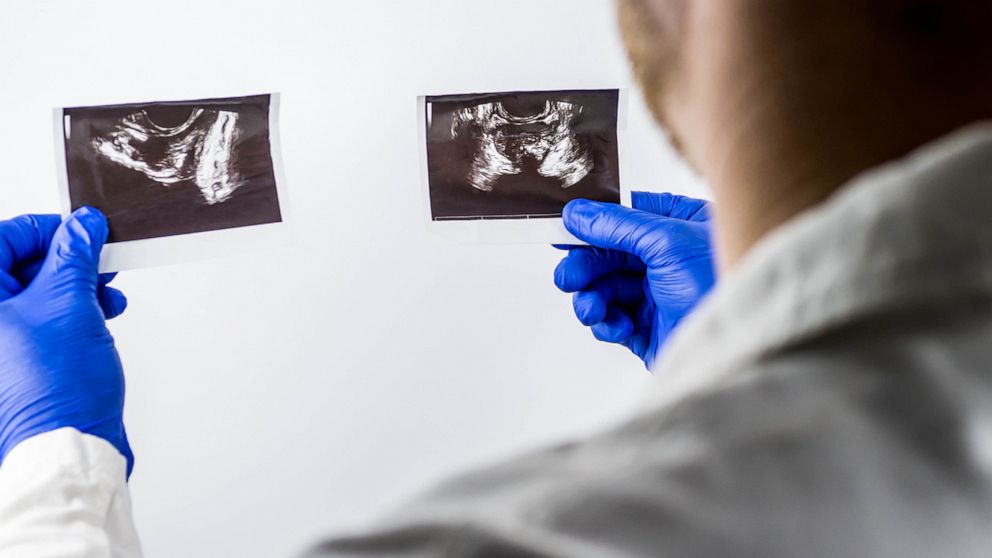 PHOTO: A doctor examines the ultrasound images of the prostate gland in an undated stock image.