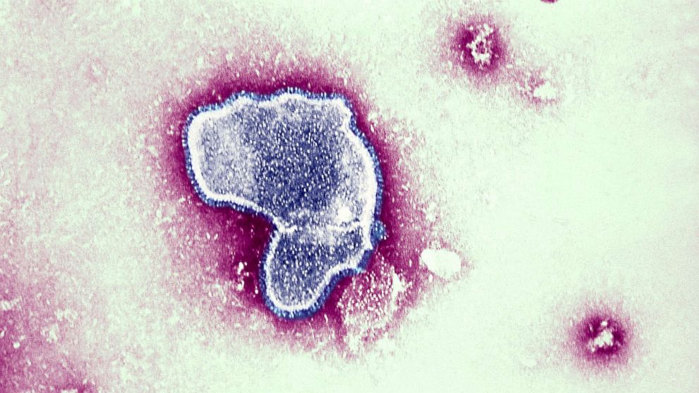 PHOTO: Thic Electron Micrograph Reveals The Morphologic Traits Of The Respiratory Syncytial Virus RSV.